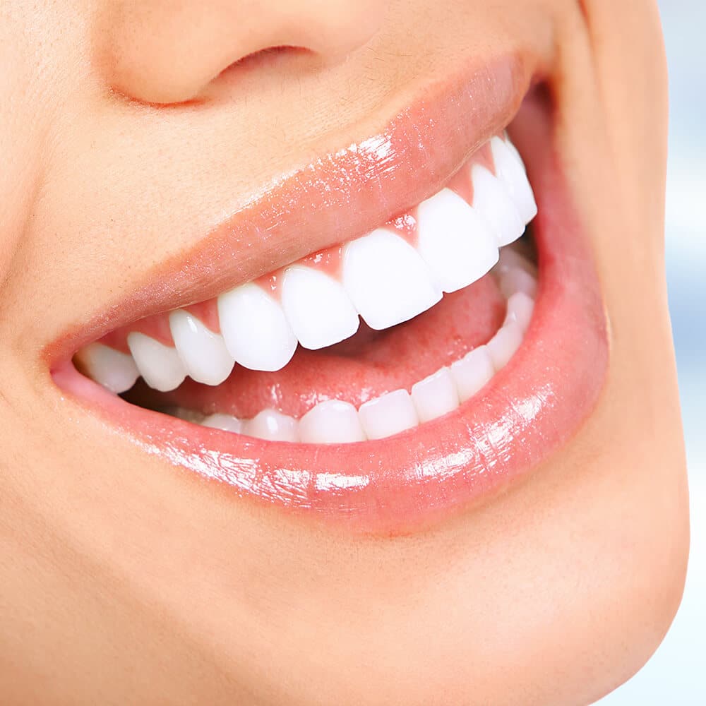 Close-up of a person's bright white smile showing healthy teeth and pink lips.