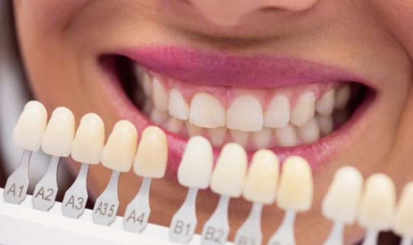 North Salt Lake Dental