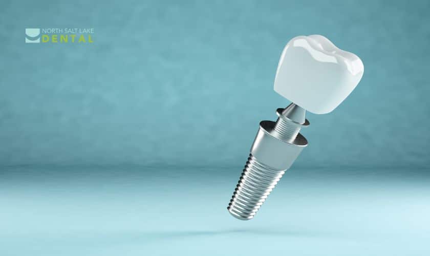 North-Salt-Lake-Dental