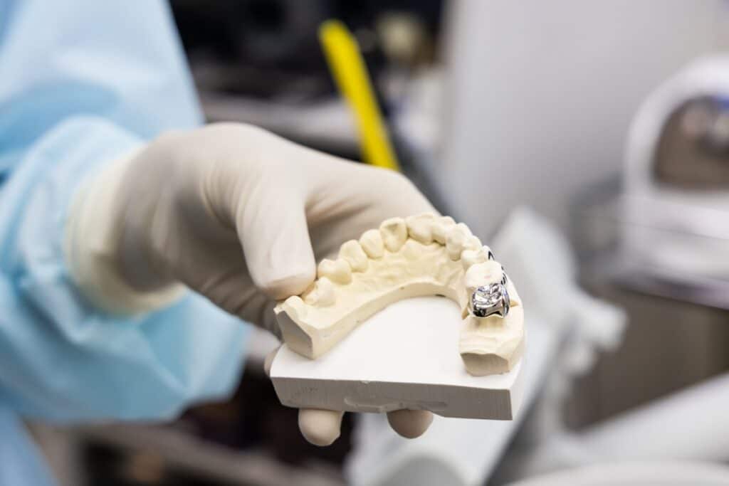 How Do Dental Crowns Affect Your Bite