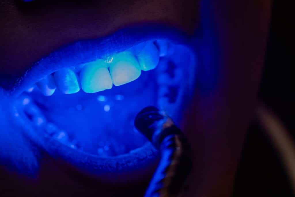 Are Dental Fillings Painful Separating Fact from Fiction
