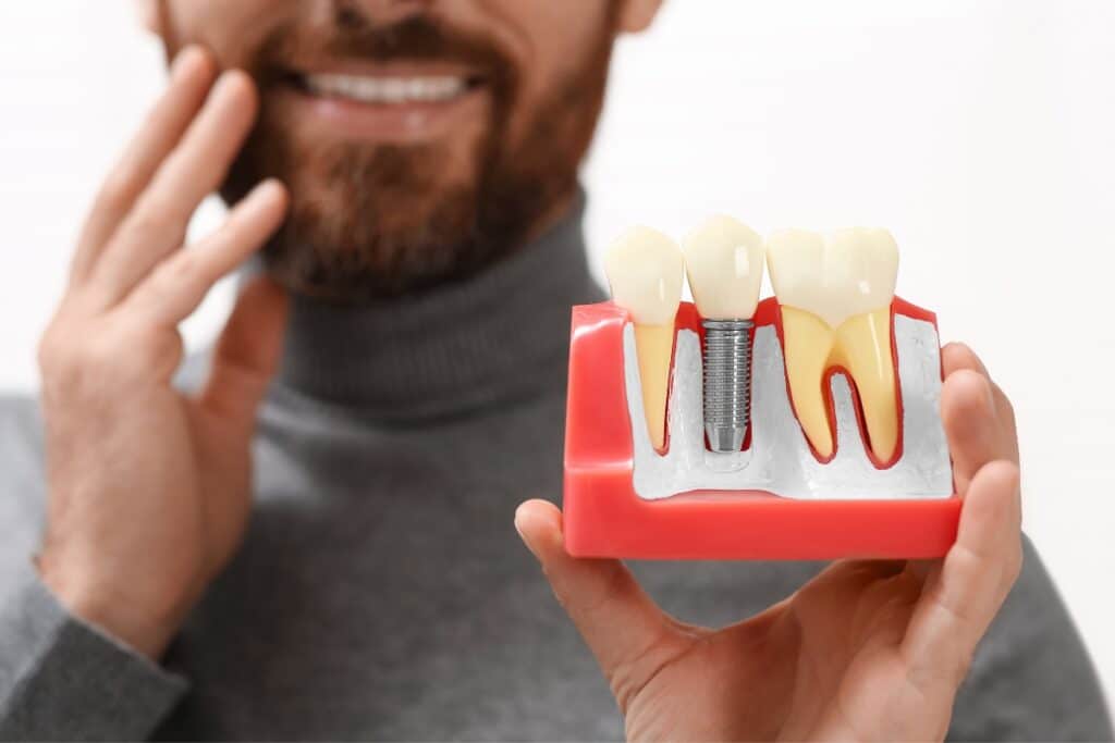 What Is The Best Age To Get Dental Implants