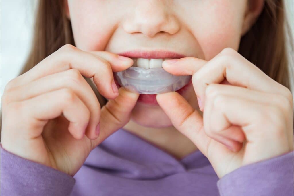 Top 5 Signs You Need a Night Guard for Teeth Grinding