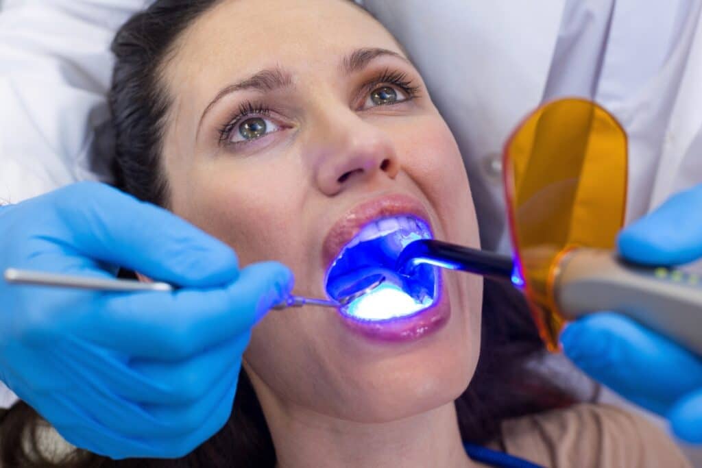 What Happens When You Over-Whiten Your Teeth